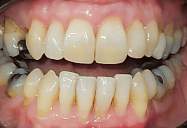 After - Stamford Dental Care