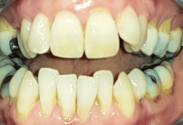 Before - Stamford Dental Care