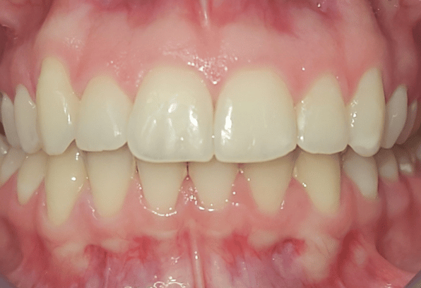 After - Stamford Dental Care