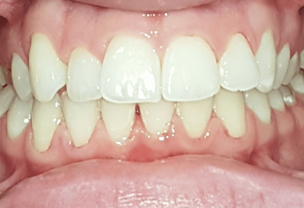 Before - Stamford Dental Care