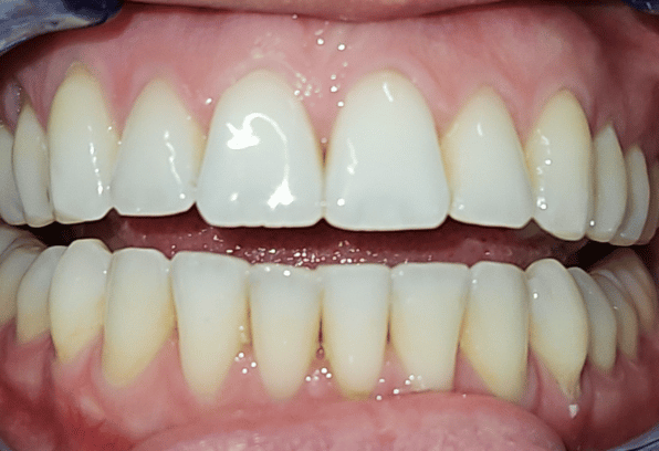 After - Stamford Dental Care