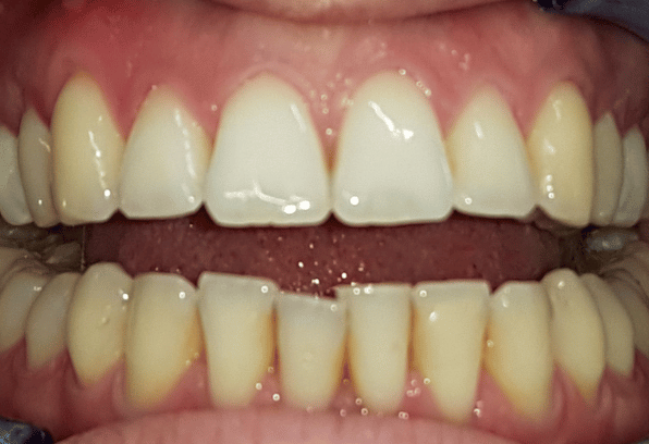 Before - Stamford Dental Care