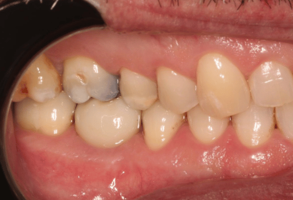 After - Stamford Dental Care