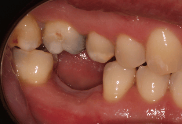 Before - Stamford Dental Care
